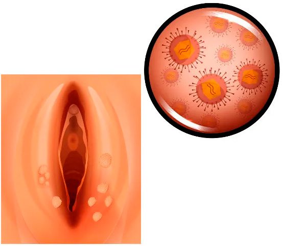 Oncologia Ginecológica